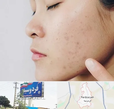 دکتر جوش صورت در فردوسیه شهریار