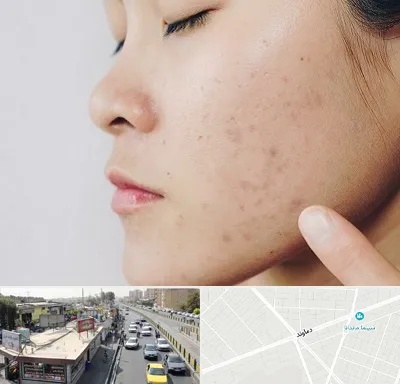 دکتر جوش صورت در خیابان دماوند