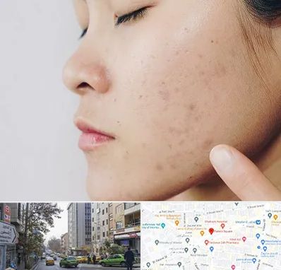 دکتر جوش صورت در فاطمی