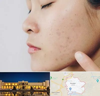 دکتر جوش صورت در برازجان