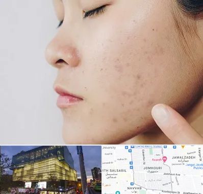 دکتر جوش صورت در جمهوری 