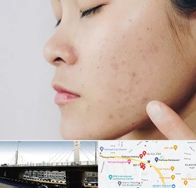 دکتر جوش صورت در پارک وی 