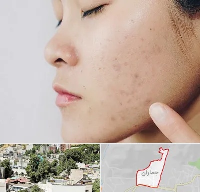 دکتر جوش صورت در جماران