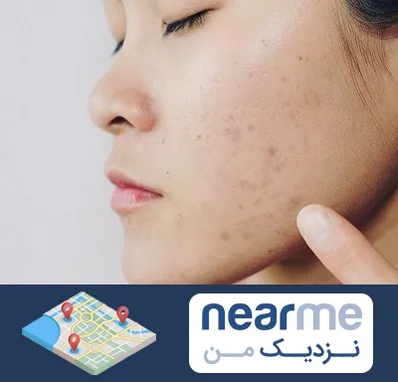 دکتر جوش صورت در نزدیک من