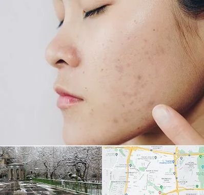 دکتر جوش صورت در باغ فیض