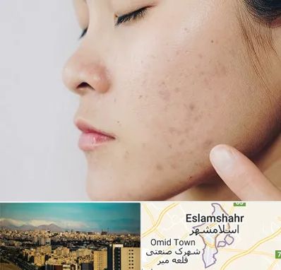 دکتر جوش صورت در اسلامشهر