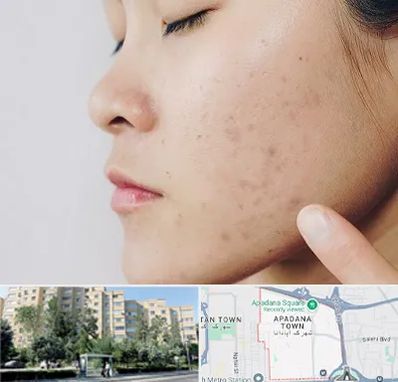 دکتر جوش صورت در آپادانا