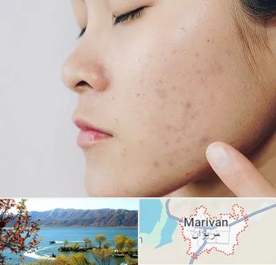دکتر جوش صورت در مریوان