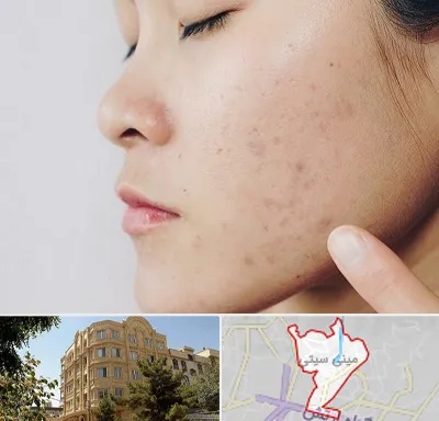 دکتر جوش صورت در مینی سیتی