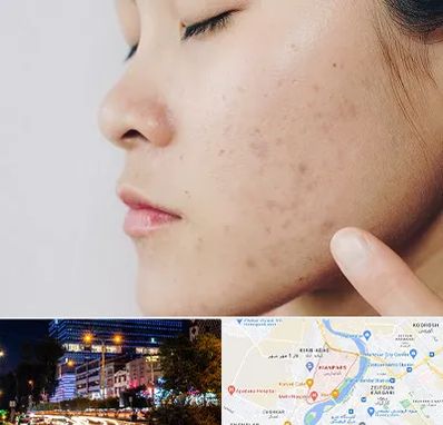 دکتر جوش صورت در کیانپارس اهواز