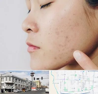 دکتر جوش صورت در 17شهریور