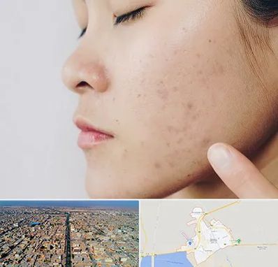 دکتر جوش صورت در بندر ماهشهر