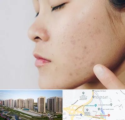 دکتر جوش صورت در المپیک 