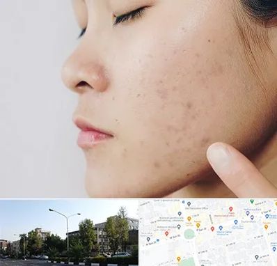 دکتر جوش صورت در میدان کاج