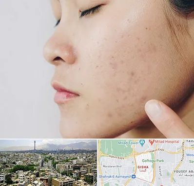 دکتر جوش صورت در گیشا 