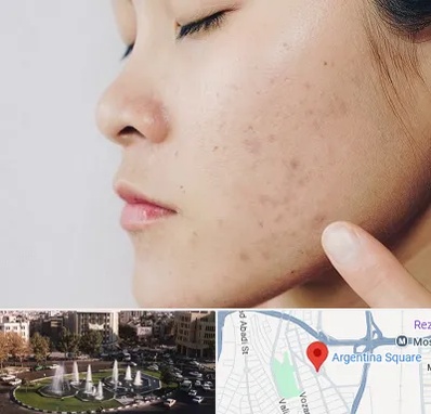 دکتر جوش صورت در آرژانتین