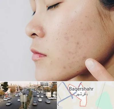 دکتر جوش صورت در باقرشهر