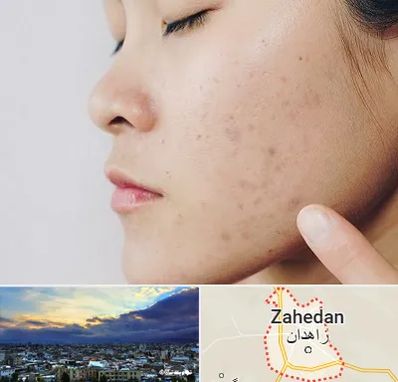 دکتر جوش صورت در زاهدان