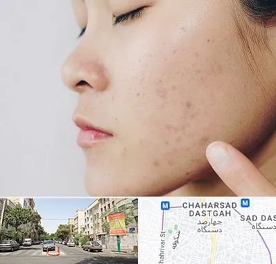 دکتر جوش صورت در چهارصد دستگاه 