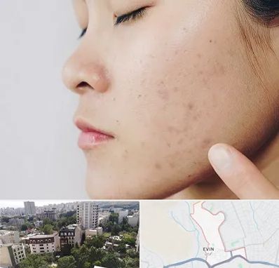 دکتر جوش صورت در اوین