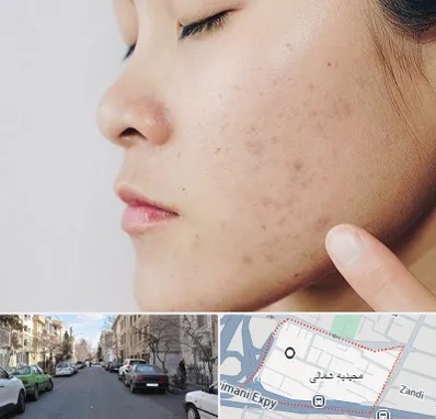 دکتر جوش صورت در مجیدیه شمالی