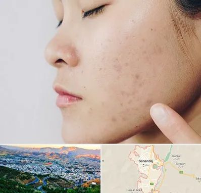 دکتر جوش صورت در سنندج