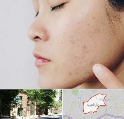 دکتر جوش صورت در دزاشیب