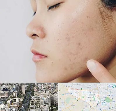 دکتر جوش صورت در منطقه 18 تهران