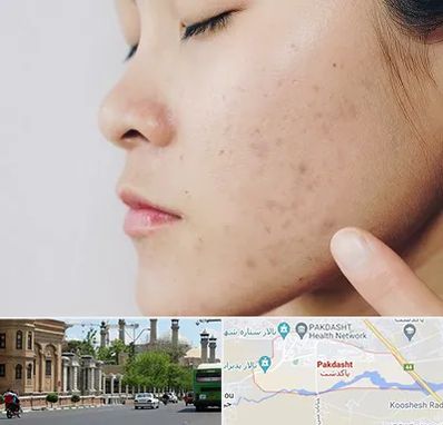 دکتر جوش صورت در پاکدشت