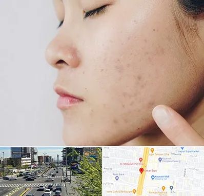 دکتر جوش صورت در ستاری