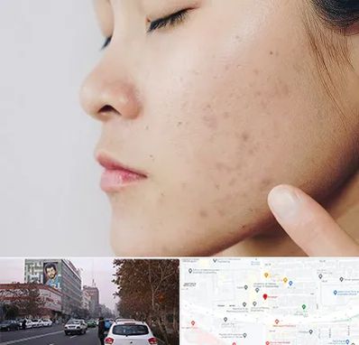 دکتر جوش صورت در کارگر شمالی