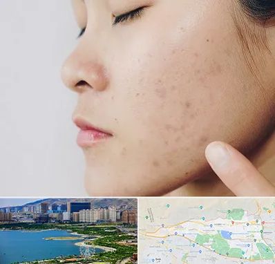 دکتر جوش صورت در منطقه 22 تهران