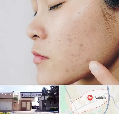 دکتر جوش صورت در وحیدیه شهریار