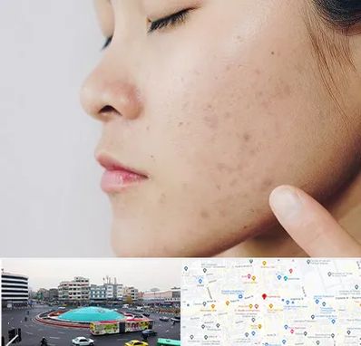 دکتر جوش صورت در میدان انقلاب