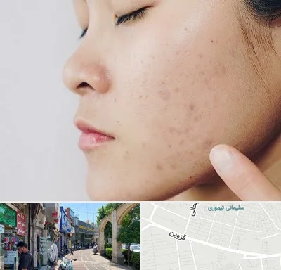 دکتر جوش صورت در خیابان قزوین