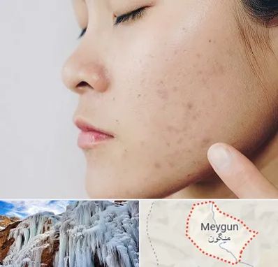 دکتر جوش صورت در میگون