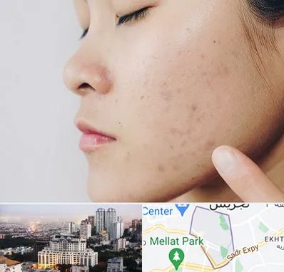 دکتر جوش صورت در الهیه 