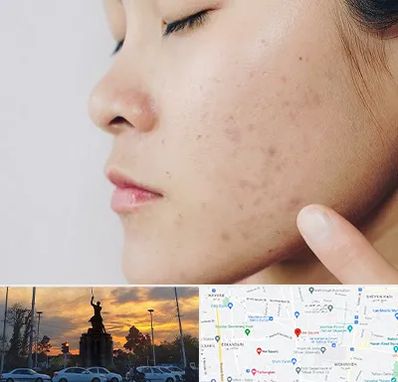 دکتر جوش صورت در میدان حر