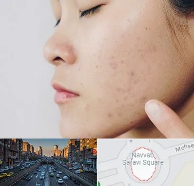 دکتر جوش صورت در نواب