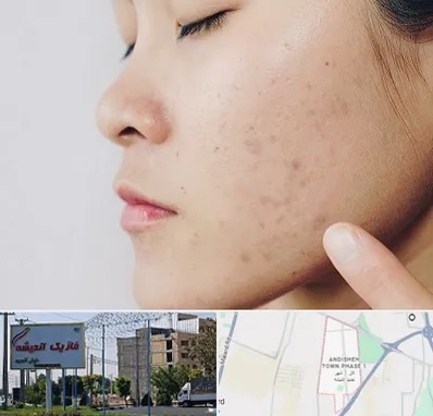 دکتر جوش صورت در فاز یک اندیشه
