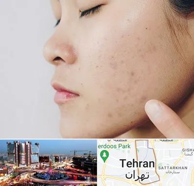 دکتر جوش صورت در صادقیه 