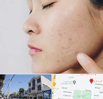 دکتر جوش صورت در افسریه 