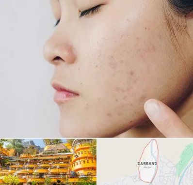 دکتر جوش صورت در دربند