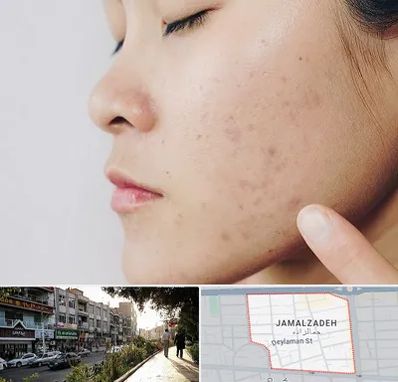 دکتر جوش صورت در خیابان جمالزاده