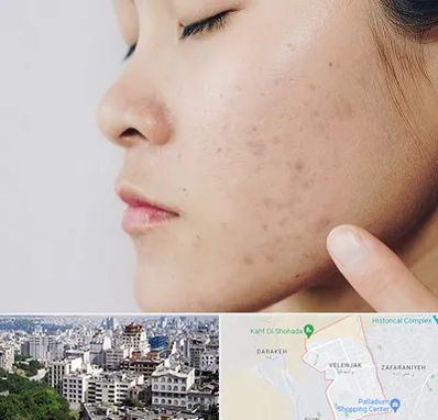 دکتر جوش صورت در ولنجک 