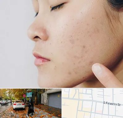 دکتر جوش صورت در خیابان فلسطین