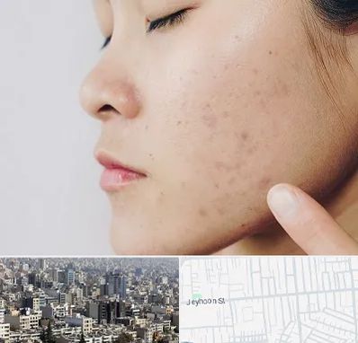 دکتر جوش صورت در جیحون