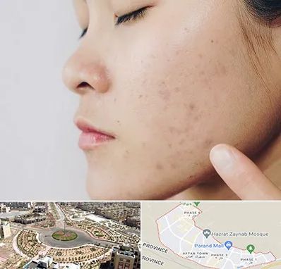 دکتر جوش صورت در پرند