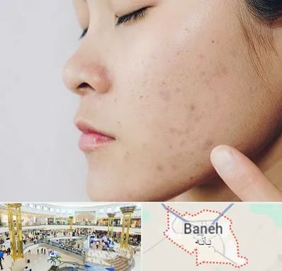 دکتر جوش صورت در بانه