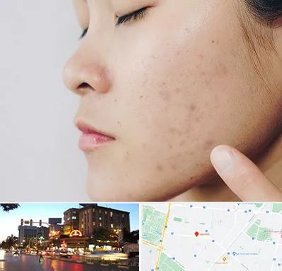 دکتر جوش صورت در بلوار سجاد مشهد